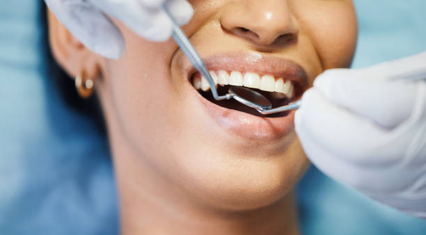 Best Emergency Broken Tooth Repair in Port Neches, TX